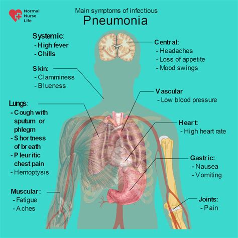 pneumonia patient diagram 